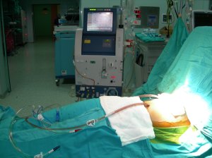 the machine that regulates the temperature of the chemotherapy (to 42 degrees centigrade)