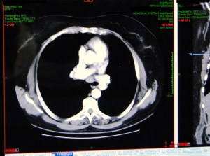 edited to preserve patient privacy