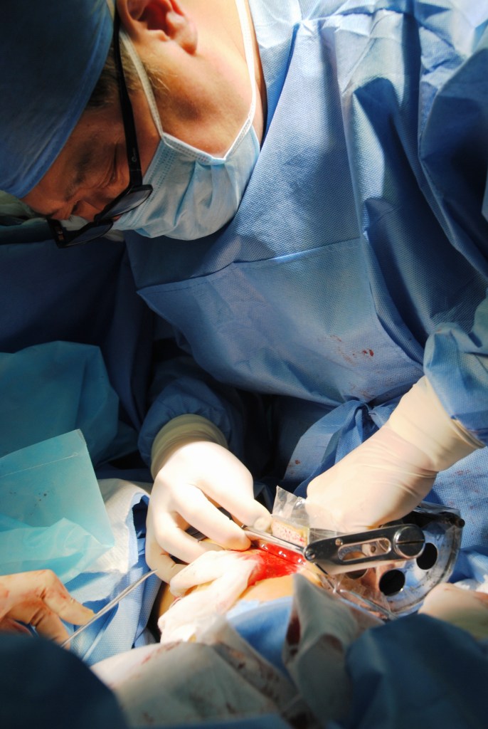 Harvesting skin from patient's thigh